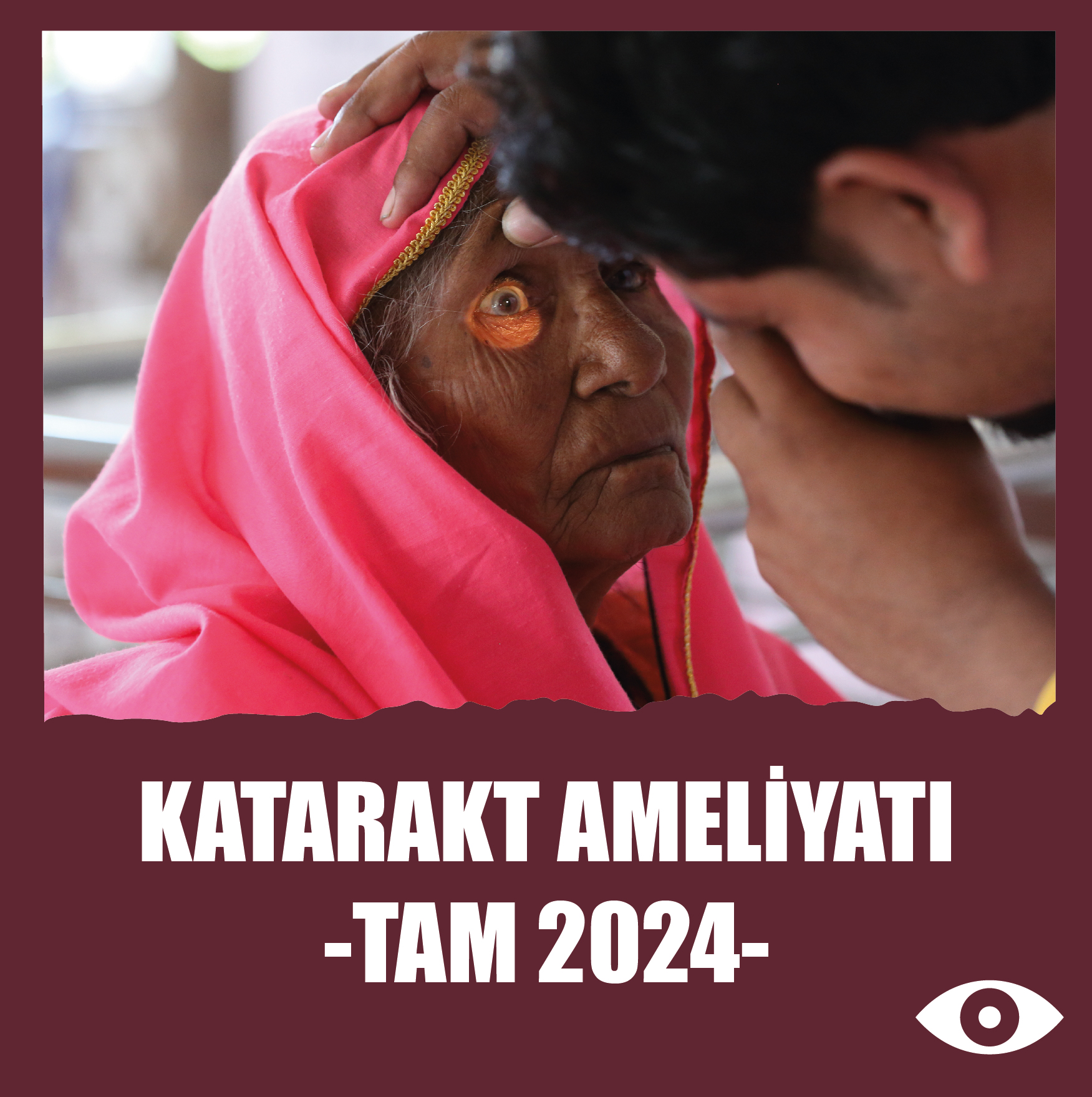Katarakt Ameliyatı